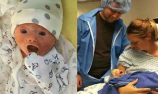 They Were Expecting A Healthy Baby But Their Lives Changed When They Saw Her